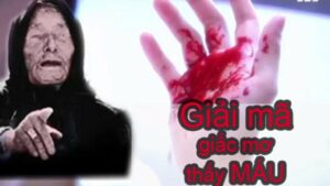 mo thay mau la diem lanh hay du