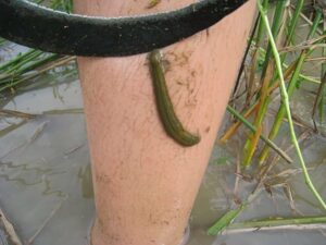 mo thay dia can vao chan