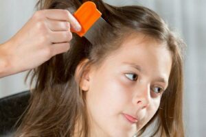 Mơ thấy bắt rận, chấy đánh con gì ?